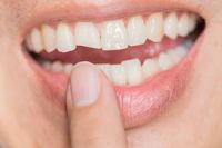 изправяне на зъби - 75699 клиенти