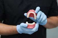 зъбни импланти - 99847 вида