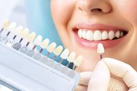 избелване на зъби цена - 43039 клиенти